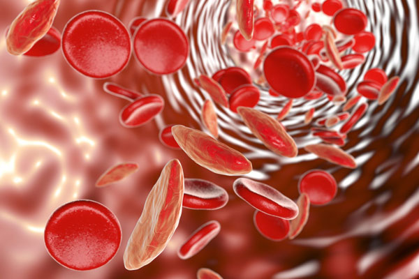 combattere-anemia-stanchezza